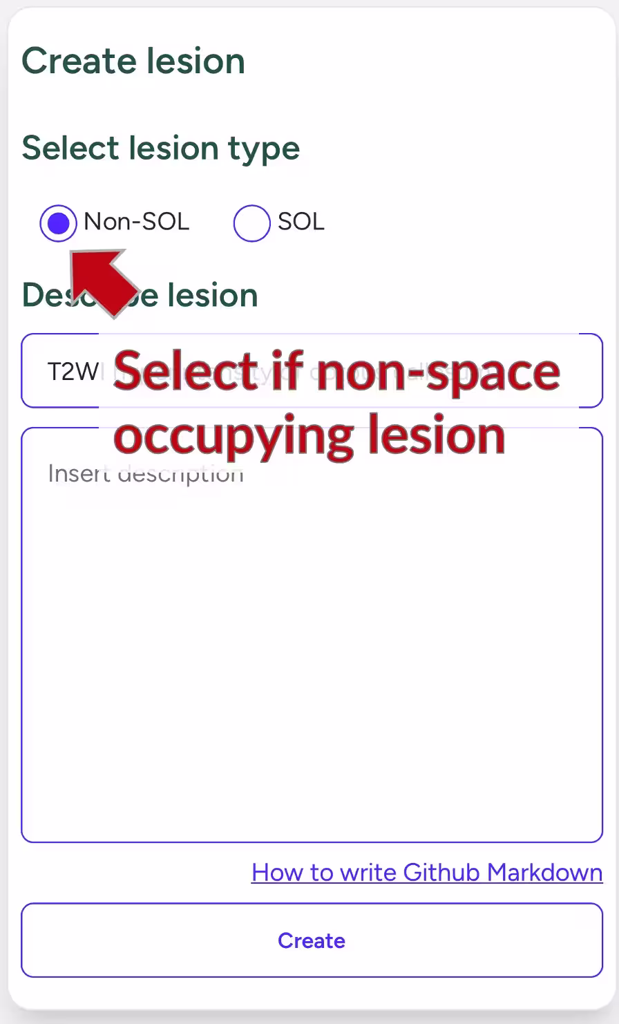 SOL or not